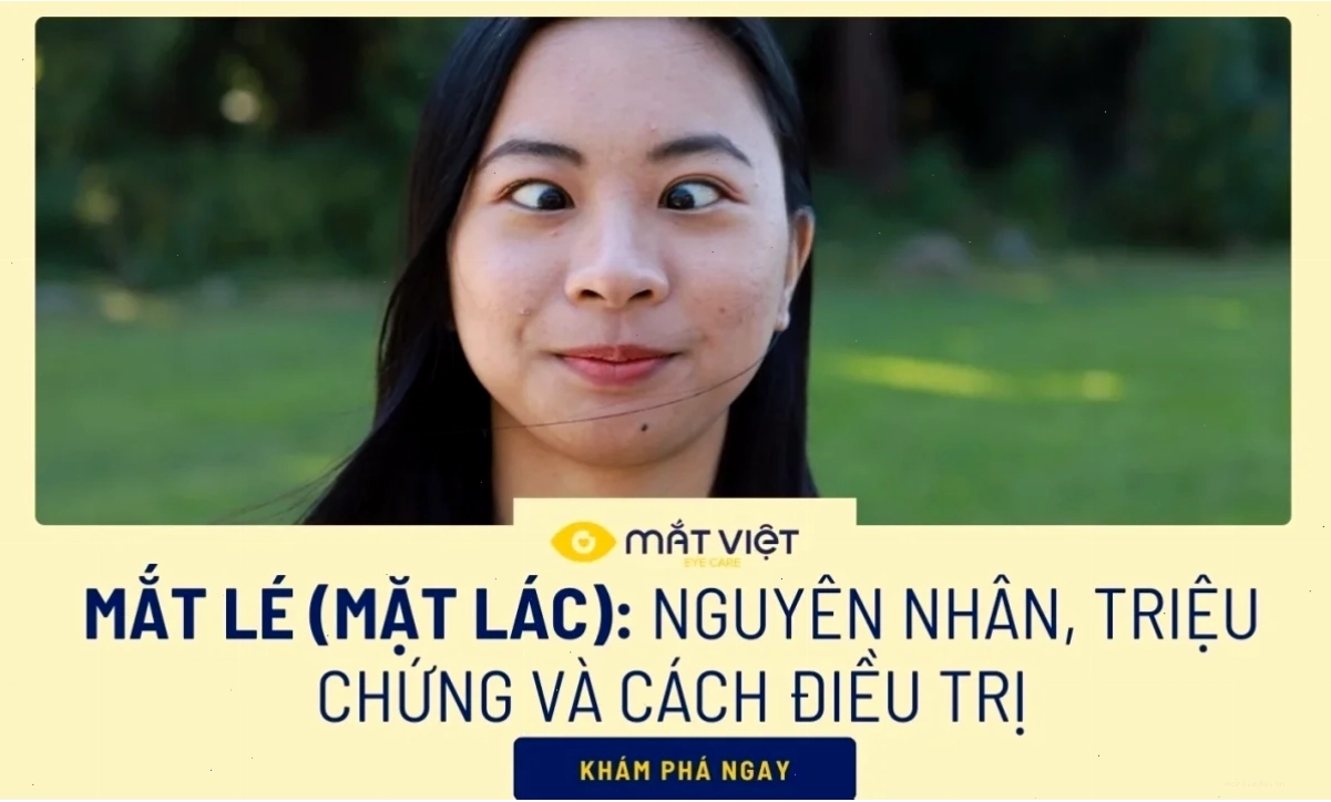 Meme mắt lác dễ thương