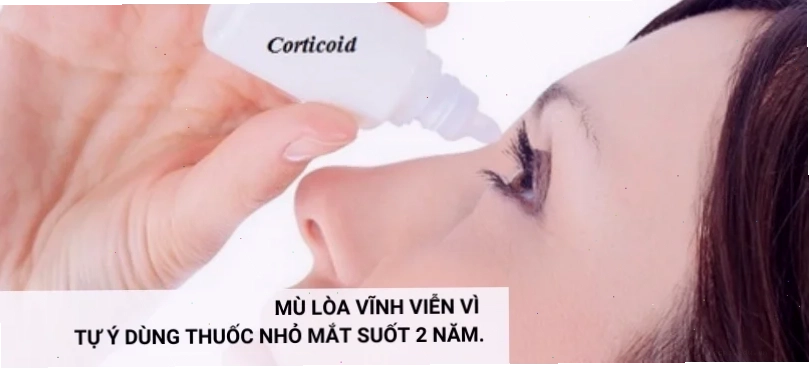 meme nhỏ mắt