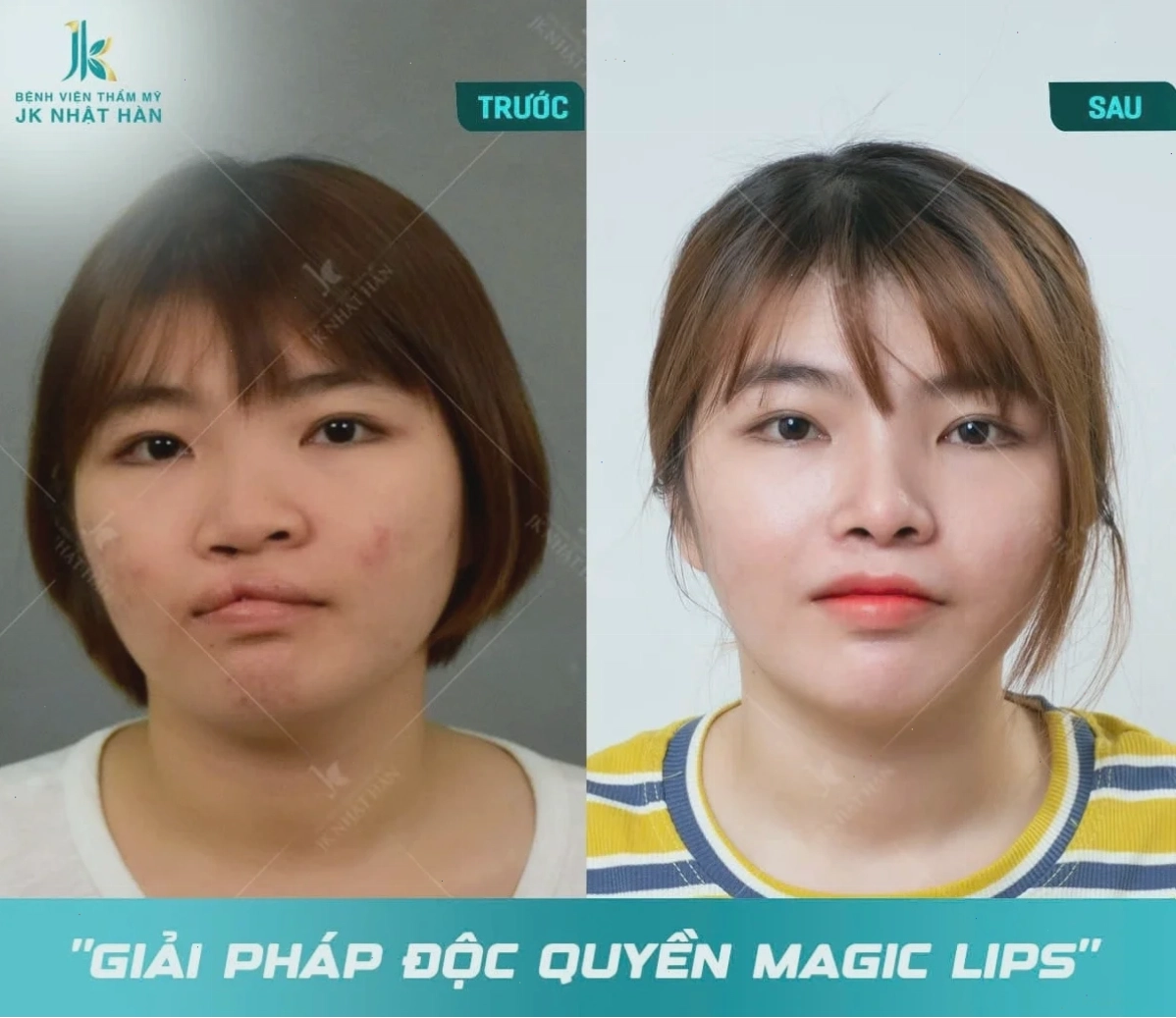 meme hài hước trề môi meme mắc cười